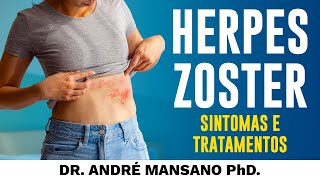 Herpes Zoster – Sintomas e Tratamentos – Dr André Mansano Tratamento da Dor [upl. by Clifton]