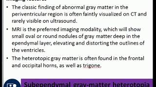 Subependymal graymatter heterotopia periventricular nodular heterotopia febrile seizures [upl. by Annahsal]