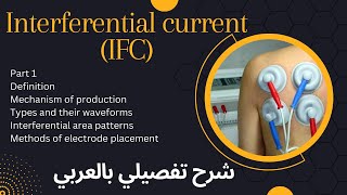 Interferential current IFCشرح تفصيلي بالعربي [upl. by Ennovad]