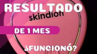 Resultado de 1 mes con SkindionMi experienciaRejuvenecimiento FacialMicro Corriente ¿Funciona [upl. by Joan827]