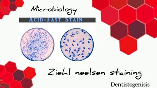 Ziehl Neelsen staining  Acid Fast staining microbiology 2ndyear BDS [upl. by Roshan]