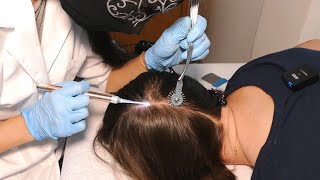 ASMR Scalp Check amp Hairline Exam with Sensory Tests Real Person [upl. by Nitsa]