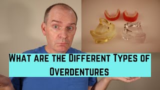 What are the different types of overdentures [upl. by Isnan658]