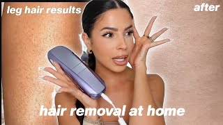 I TRIED LASER HAIR REMOVAL AT HOME this is what happened [upl. by Aneis]