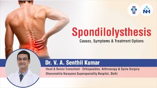 Spondylolisthesis  Causes Symptoms and Treatment Options  Dr V A Senthil Kumar [upl. by Ecirp403]