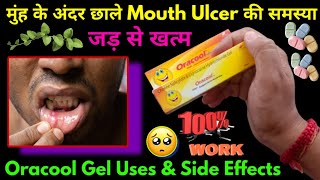 Oracool gel  Oracool gel kaise use kare  Oracool gel uses in hindi  Mouth ulcer treatment [upl. by Graehme404]