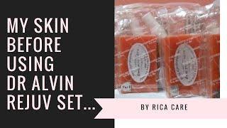 Dr Alvin Skin Rejuvenating Set My Skin before using the product [upl. by Henriques987]