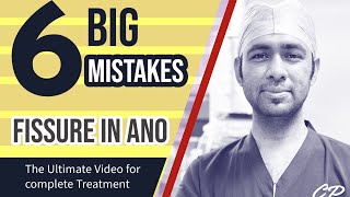 6 BIGGEST MISTAKES in FISSURE  Watch complete video for best results for pain in Fissure Treatment [upl. by Ahsiner]