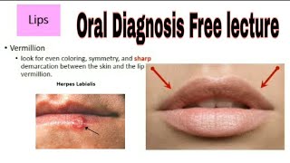 Intraoral Examination Oral Diagnosis [upl. by Perretta]