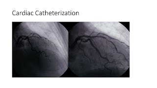 Cardiac Catheterization [upl. by Attevaj396]