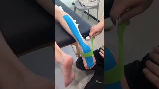 Use kinesiology tape to stabilize the ankle Achilles tendon to reduce running injuries [upl. by Leanna517]