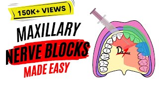 Maxillary Nerve Block Anesthesia For Dental Procedures [upl. by Gherardo]