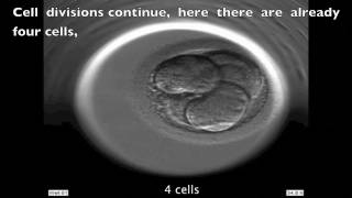 INSTITUT MARQUÈS  Development of a human embryo seen with Embryoscope [upl. by Tychon]