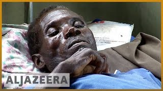 🇿🇼 💉 Zimbabwe cholera outbreak State of emergency declared  Al Jazeera English [upl. by Nicko]