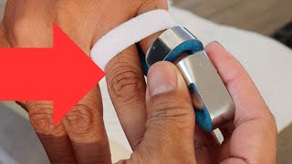 How To Apply a Mallet Finger Splint EASY WAY [upl. by Nuhsed]