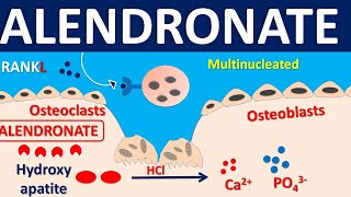 Alendronate for osteoporosis  Mechanism side effects precautions amp uses [upl. by Asilak89]