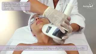 MeDioStar NeXT PRO XL  Training video for hair removal with BASIC mode from Asclepion [upl. by Clary]