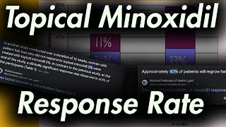 Topical Minoxidil Response Rate [upl. by Orelie]