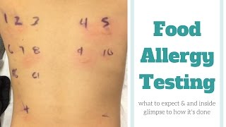 Food Allergy Testing [upl. by Anilek517]