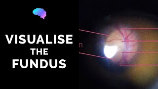 Fundoscopy  How to Visualise the Fundus  Direct Ophthalmoscopy  OSCE Guide  UKMLA  CPSA [upl. by Glaudia]