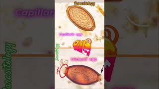 Capillaria egg amp Trichuris egg 👍Parasitology👍🤔📚🔬✅ [upl. by Volding]