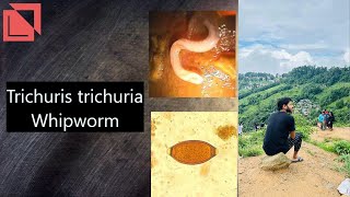 parasitology Trichuris trichura Whipworm norcet microbiology labtechnician mltlab [upl. by Cindie]