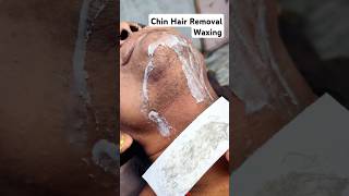 Chin Hair Waxing  Chin Hair Removal hairremoval chinwaxing [upl. by Northington]