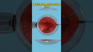 Watch how IVF invitro fertilization is done [upl. by Onirotciv35]