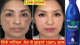 नारियल तेल में बस 1 चीज़ मिलने से झाइयों को जड़ से ख़त्म करें Pigmentation Removal [upl. by Tarkany]