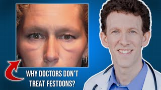 Why Many Doctors Dont Treat Festoons [upl. by Janicki]