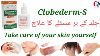 ClobedermS Lotion uses benefits in UrduHindi [upl. by Nahsez460]