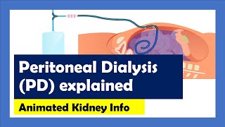 Peritoneal Dialysis explained [upl. by Henning606]