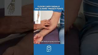 Is Your Wrist Pain Caused By Trigger Points In the Forearm Flexors [upl. by Nitsreik]