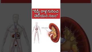 Unknown facts about kidney stones kidneystone telugufacts health [upl. by Ayrb]