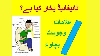 Typhoid Fever Information in Urdu [upl. by Nnazus]