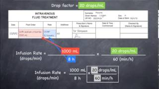 Calculating infusion rates in dropsmin 20 dropsmL [upl. by Secnirp]