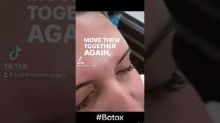 Watch Us Freeze Her Forehead Botox [upl. by Neona]