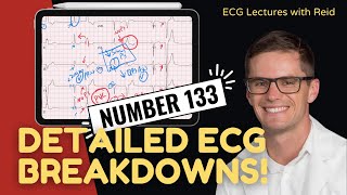 EKG Test Yourself  ECG Case Study 133 [upl. by Eibot]