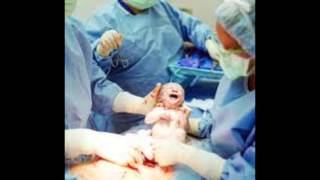 VIDEO TETANO NEONATAL [upl. by Eyram]