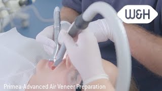 Primea Advanced Air Veneer Preparation [upl. by Amice171]