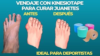 VENDAJE SENCILLO y EFICAZ para CURAR JUANETES con KINESIOTAPE [upl. by Hyacintha]