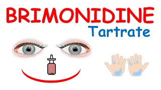 Brimonidine tartrate eye drops [upl. by Colburn]