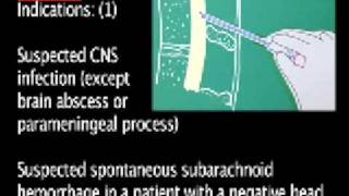 Lumbar Puncture Procedure [upl. by Blanca]