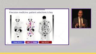 How I Select Patients for LutetiumPSMA Radioligand Therapy [upl. by Retse294]