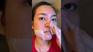 Buy here httpsbitly49qPHgI ⬅️ honest review of the madecassosside toner pads on acne prone s [upl. by Emia]