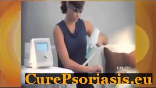 Vitamin C For Psoriasis [upl. by Sirenay]