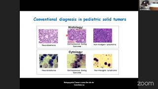 Flow cytometry for pediatric tumors diagnosis  Dr Elaine Sobral da Costa IPPMGUFRJ [upl. by Pinebrook]