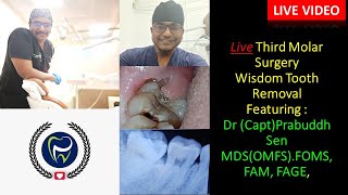 Dr Rudra Mohan  Live Wisdom Tooth Surgery  Lower Wisdom tooth Removal Dr Prabuddh Sen [upl. by Yanrahs]