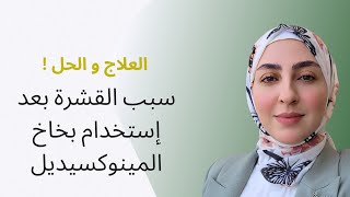 سبب ظهور القشرة بعد إستخدام المينوكيسيديل و طريقة العلاج [upl. by Reaht]