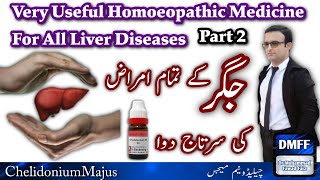 Chelidonium Majus Q chelidonium homeopathic medicine  fatty liver  jigar ki garmi ka ilaj Part 2 [upl. by Liddle]